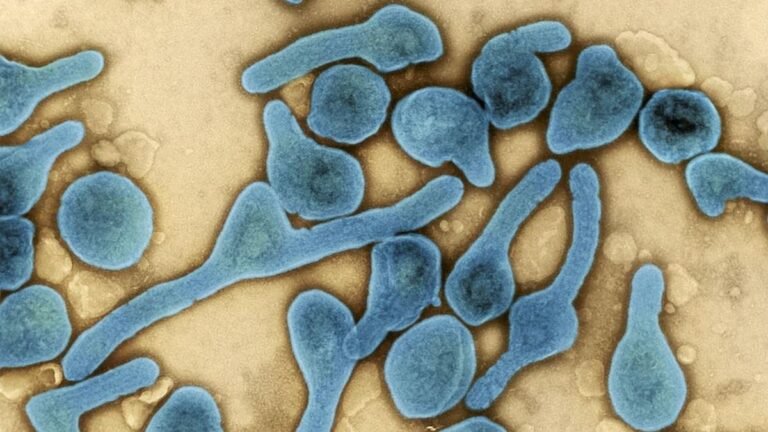 virus-marburg_169.jpeg