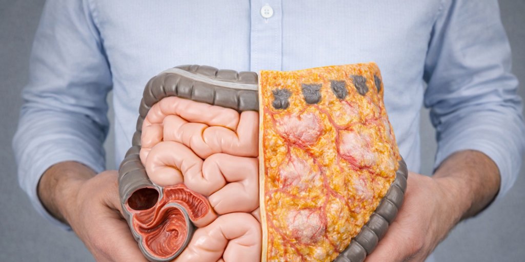 intestino-permeable-U40711172227hbB-1024x512@diario_abc.png
