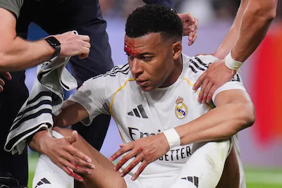 real-madrid-s-kylian-mbappe-receives-medical-attention-during-a-spanish-la-liga-soccer-match-between.webp