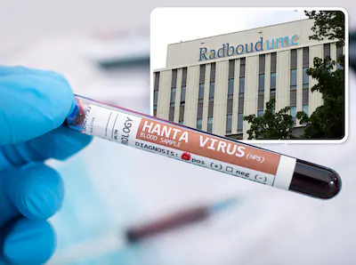 hantavirus.webp